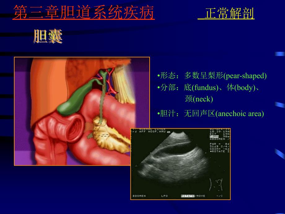 胆系疾病超声诊断PPT课件.ppt_第3页