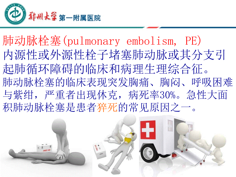 下腔静脉滤器的选择介绍.ppt_第3页
