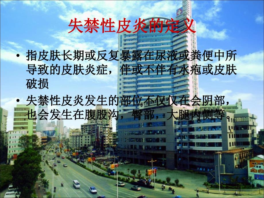失禁性皮炎的护理PPT课件.ppt_第2页