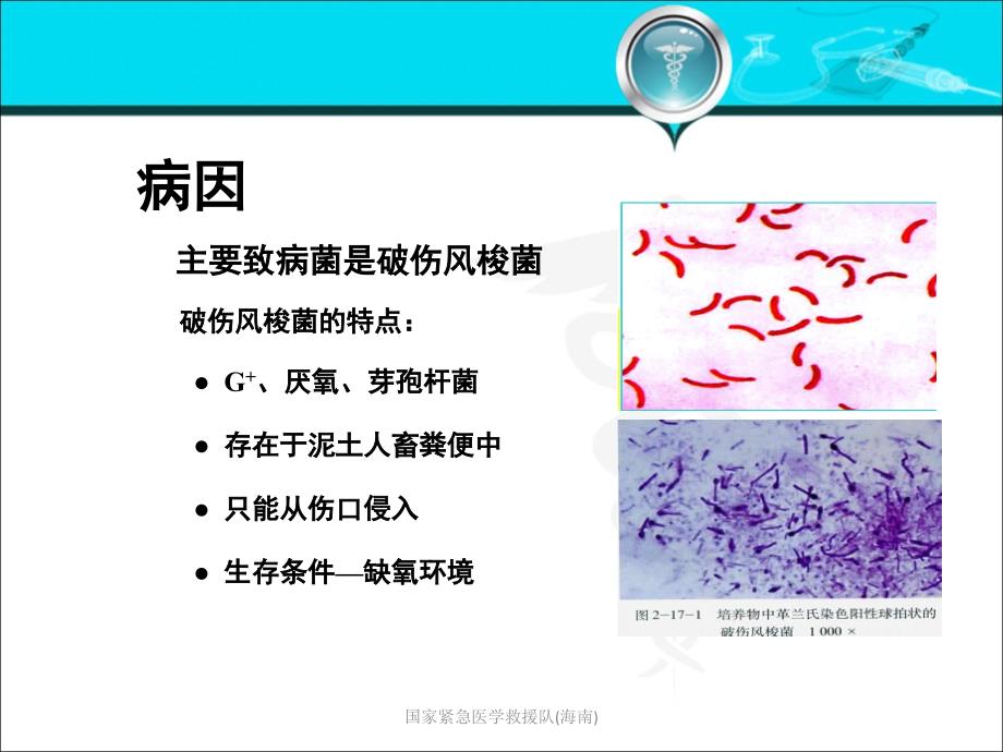 破伤风新课件.ppt_第3页