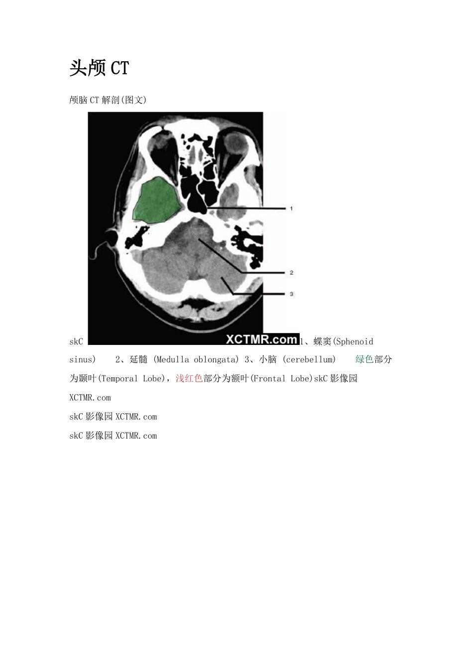 一起学CT之头颅CT.doc_第1页