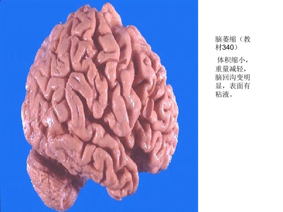 病理实验图文并茂X考试图片.ppt_第2页