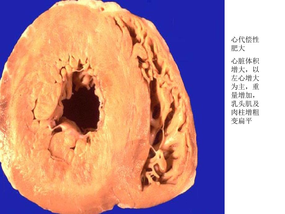 病理实验图文并茂X考试图片.ppt_第3页