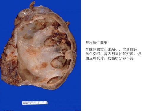 病理实验图文并茂X考试图片.ppt