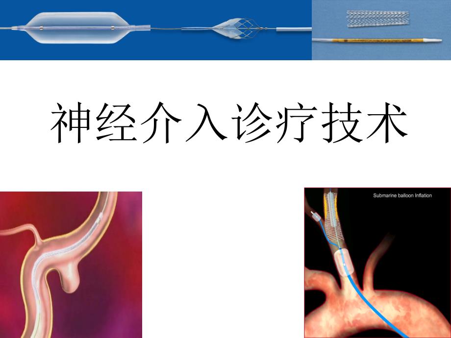 神经介入概述ppt课件.ppt_第1页