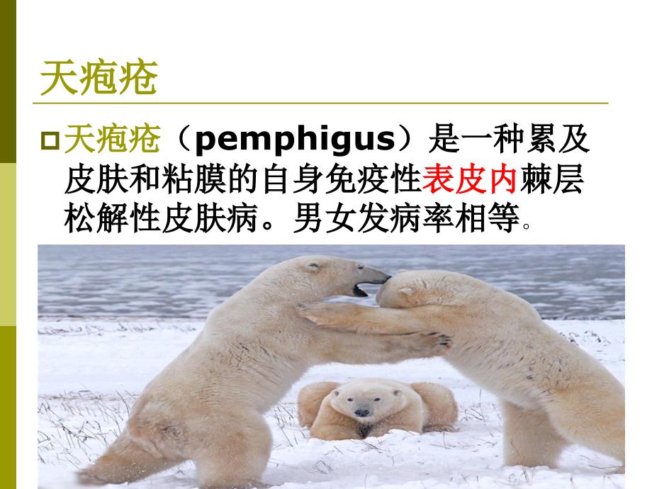 天疱疮患者的护理.ppt_第2页