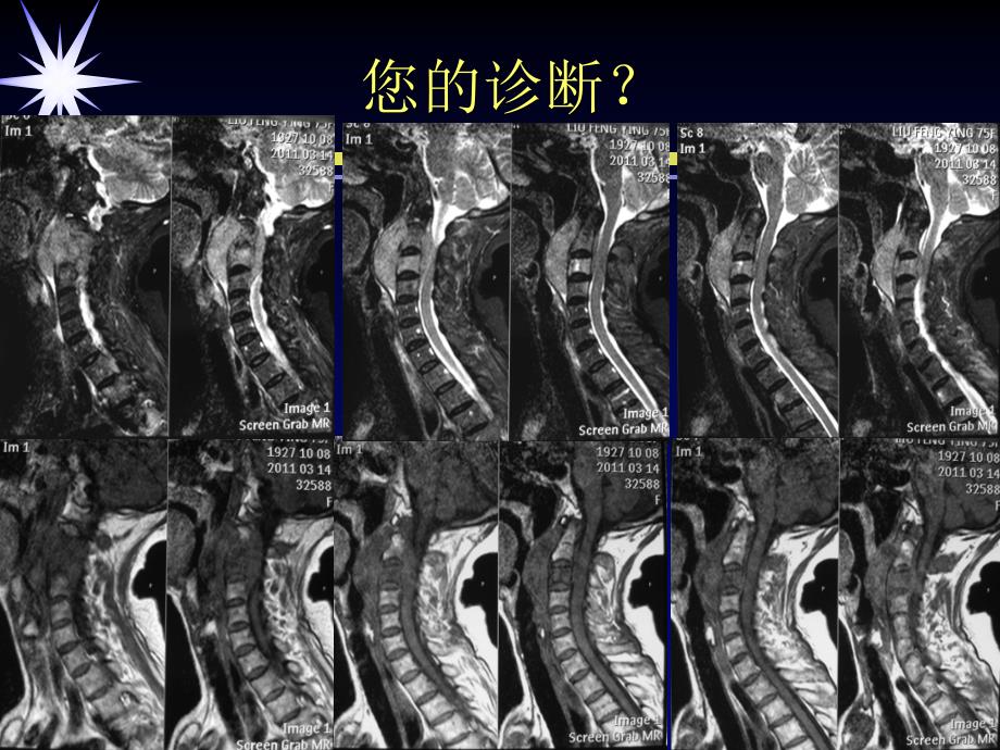 磁共振类PET临床应用.ppt_第2页