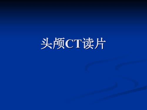 头颅CT读片PPT课件.ppt