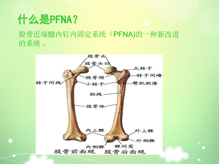 PFNA髓内钉手术配合.ppt_第2页