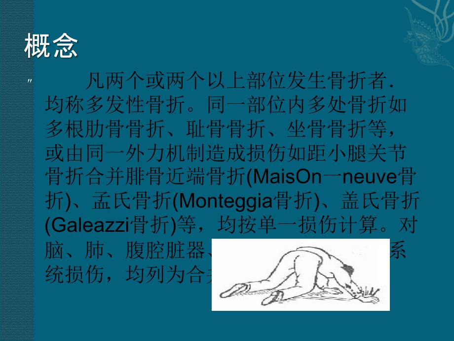 多发性骨折护理查房ppt课件.ppt_第2页