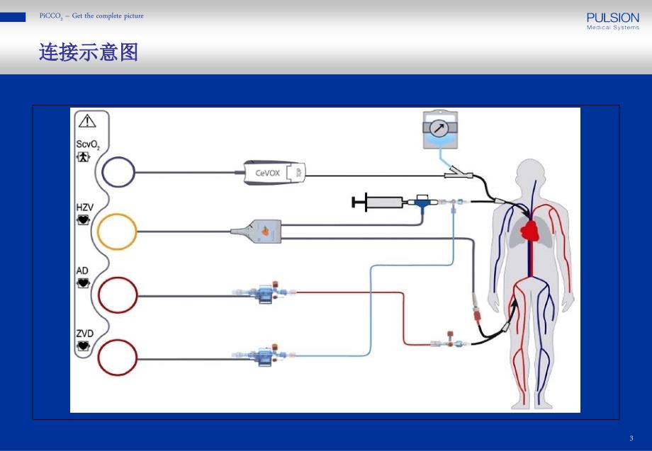 PiCCO参数解读已看两遍很好.ppt_第3页