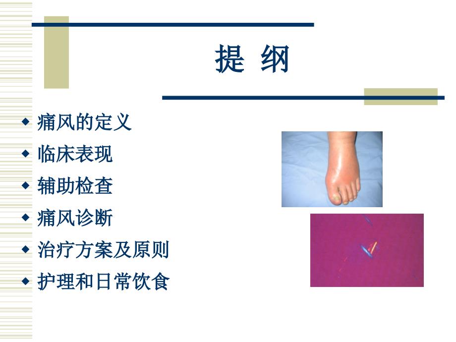 痛风病人的护理课件.ppt_第2页