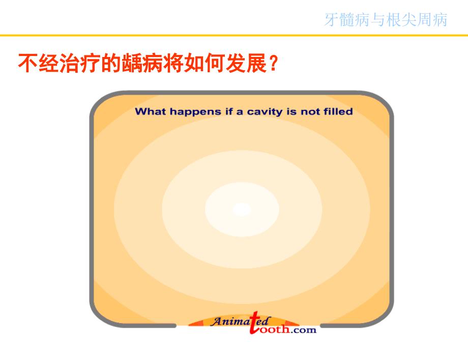 牙髓病与根尖周病PPT课件.ppt_第3页