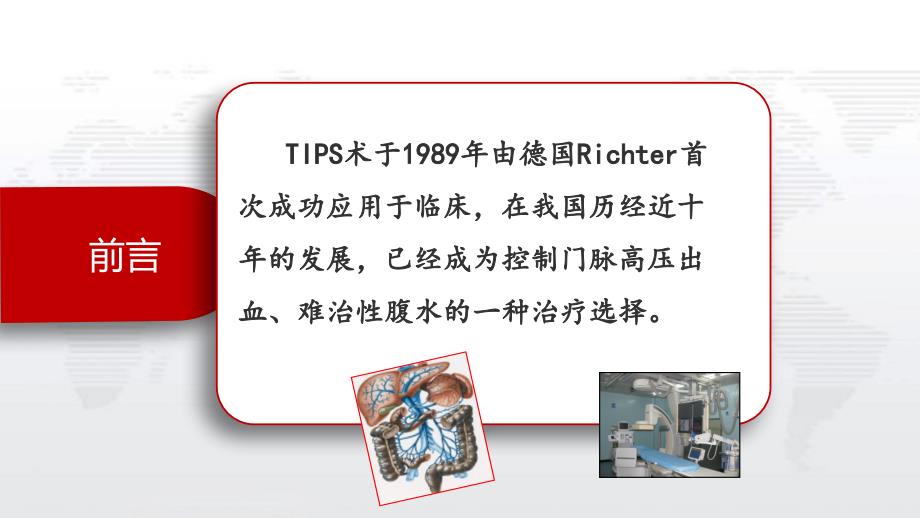 TIPS护理查房PPT课件.ppt_第2页