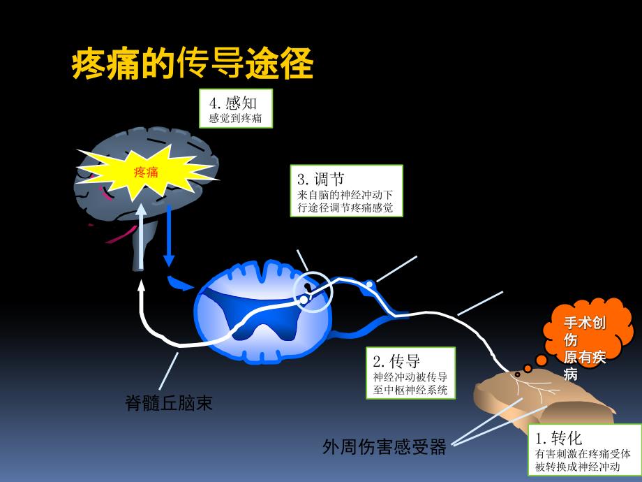 疼痛科科普PPT课件.pptx_第3页