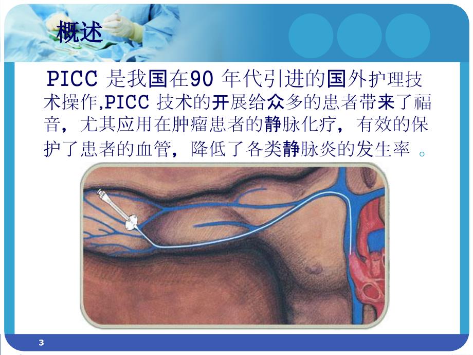 PICC的临床应用及维护ppt课件.ppt_第3页