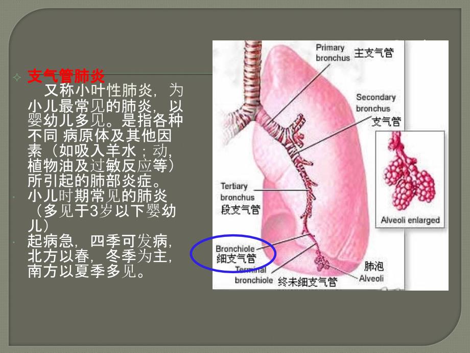 小儿支气管肺炎ppt课件.ppt_第2页