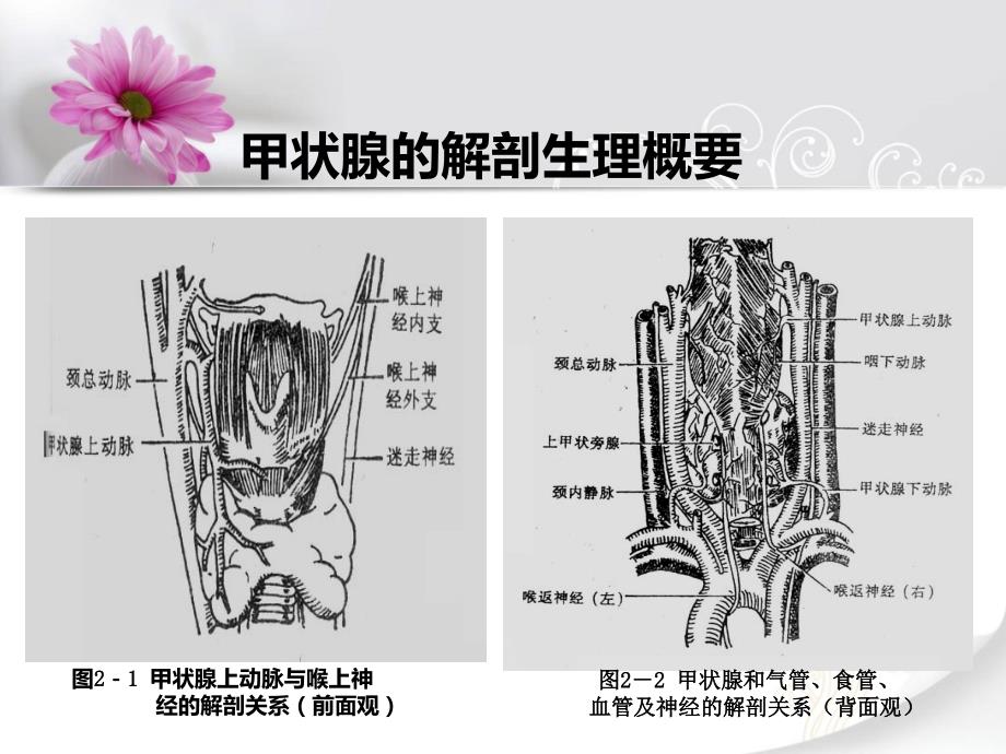甲状腺疾病病人的护理ppt.ppt_第3页