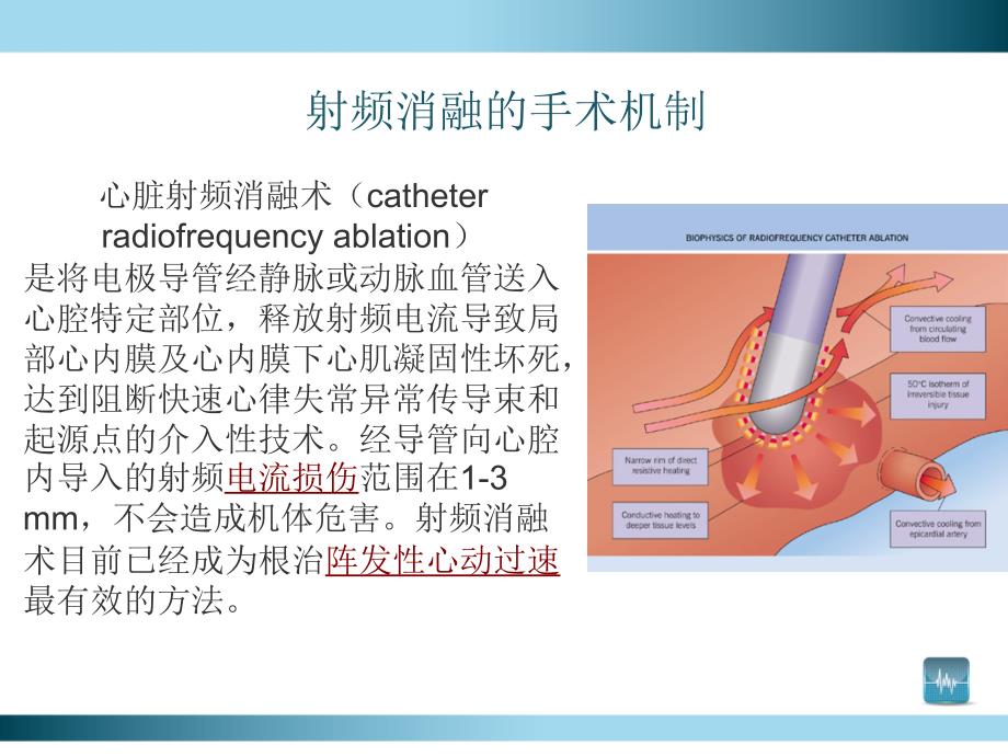 射频消融手术概述.ppt_第2页