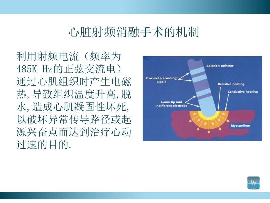 射频消融手术概述.ppt_第3页