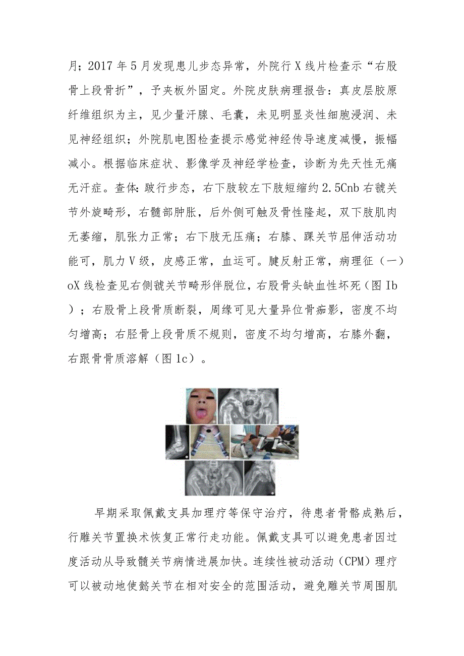 外科先天性无痛无汗症病例分析专题报告.docx_第2页