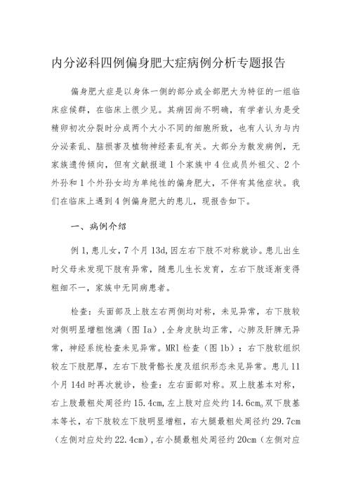 内分泌科四例偏身肥大症病例分析专题报告.docx