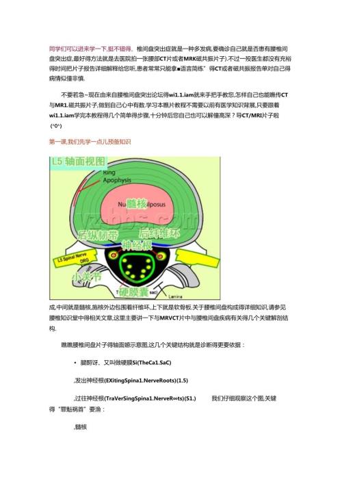 腰椎MR一瞧就会.docx