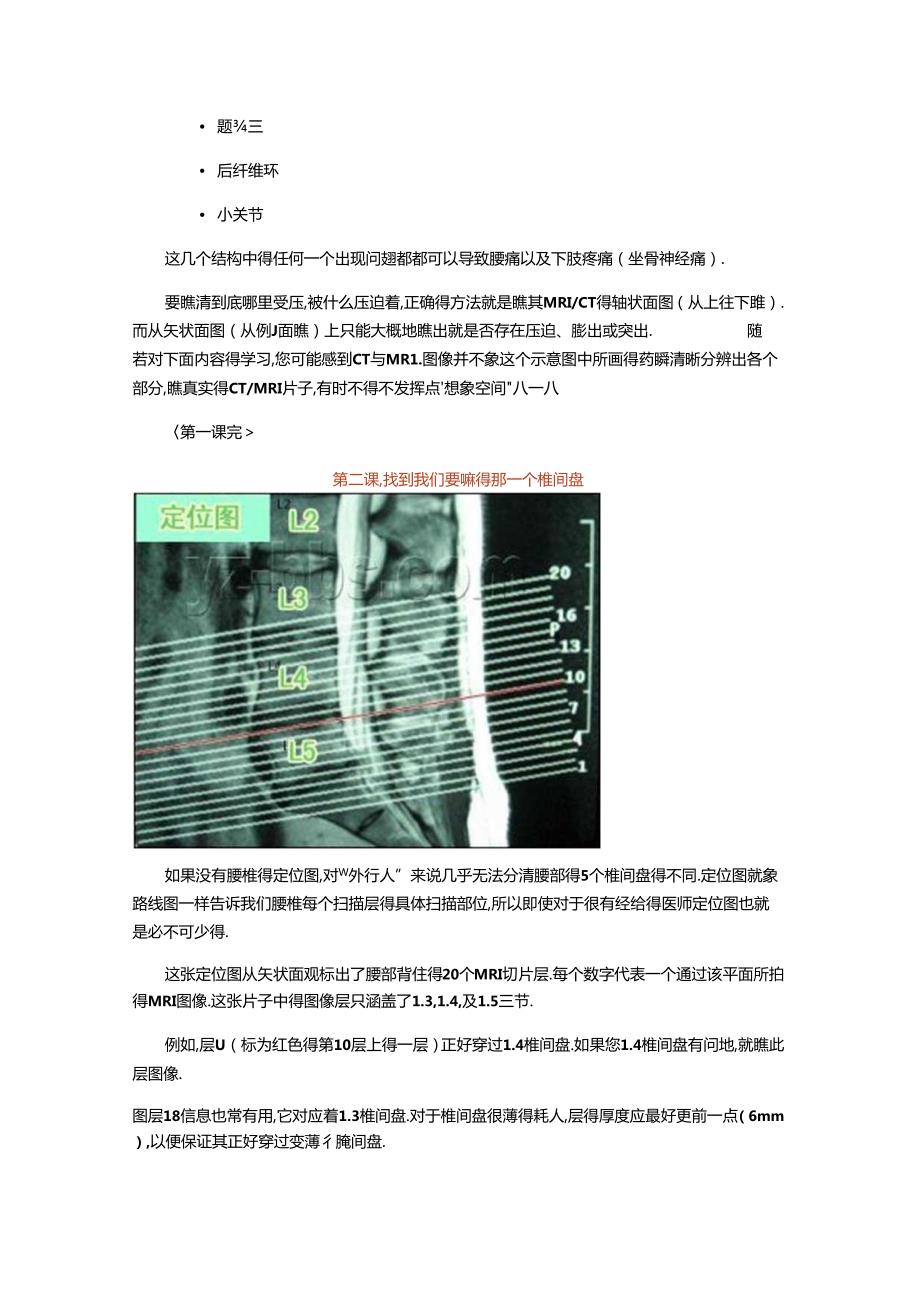 腰椎MR一瞧就会.docx_第2页