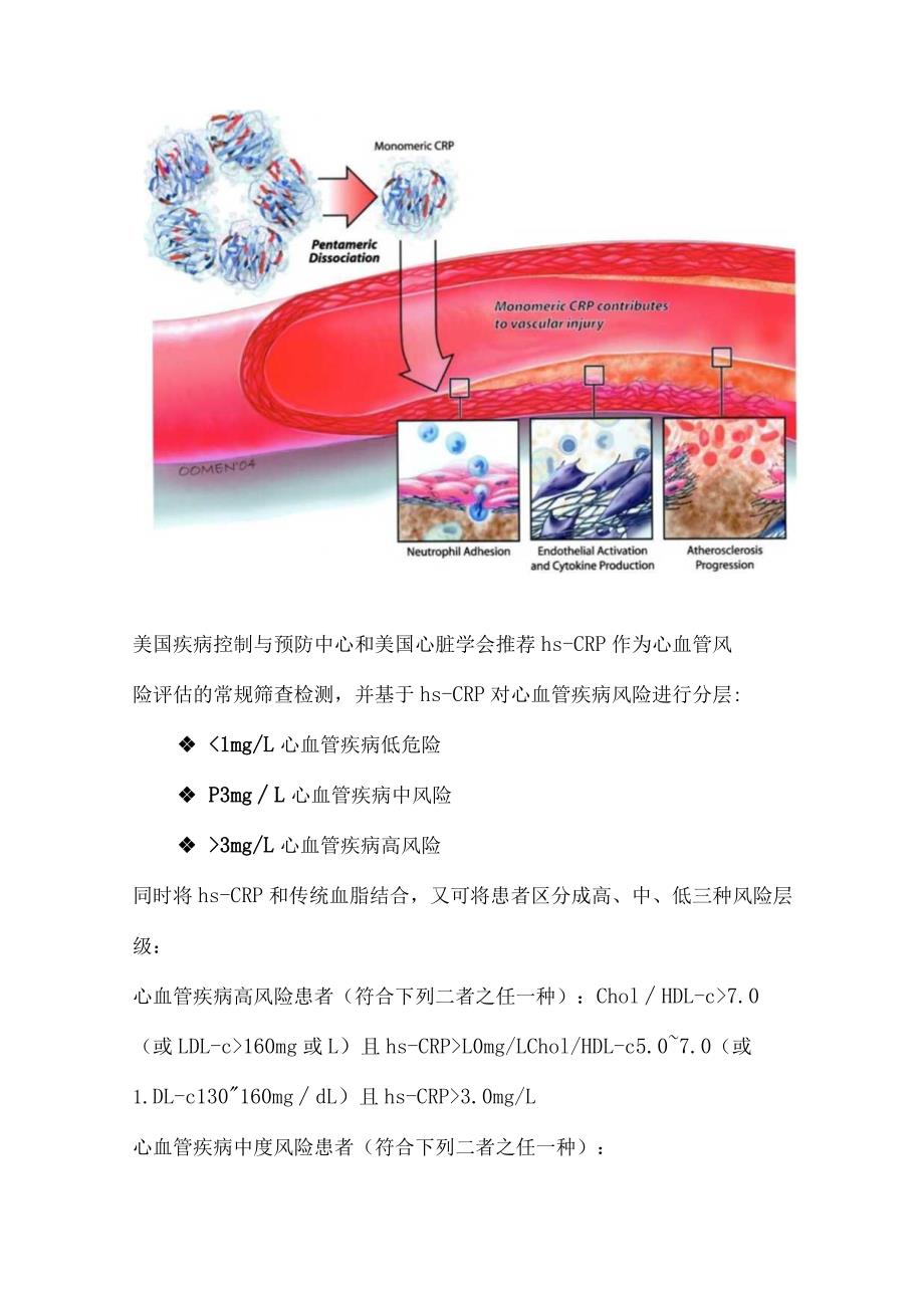 C反应蛋白与超敏C反应蛋白的区别.docx_第3页