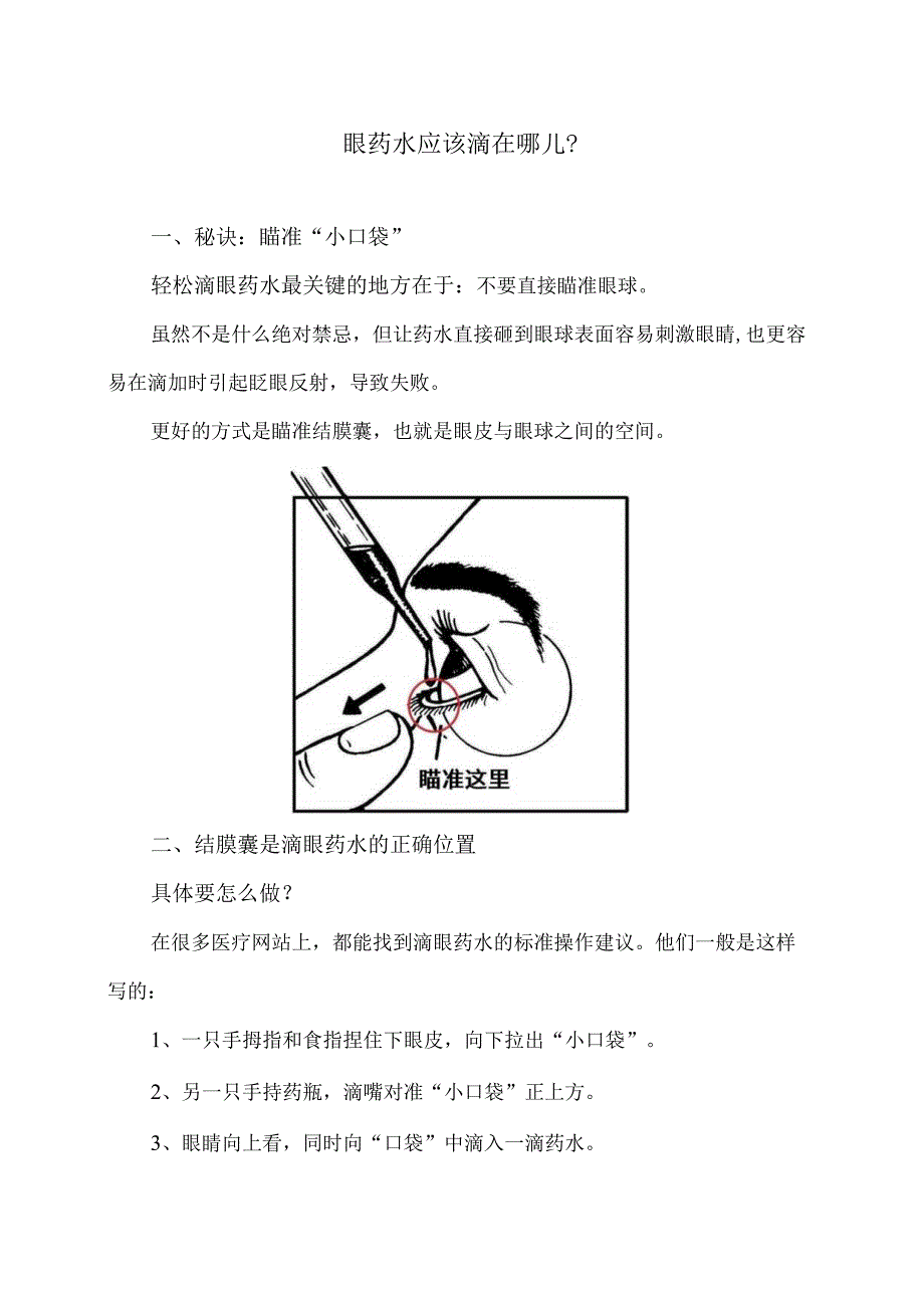 眼药水应该滴在哪儿？（2024年）.docx_第1页