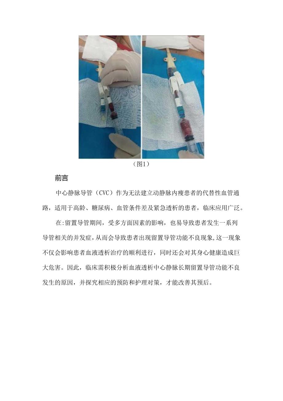 血液透析患者中心静脉导管功能不良预防及处理.docx_第2页