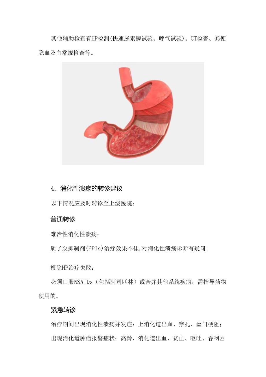 消化性溃疡的基层诊断和治疗方案（2023年）.docx_第3页