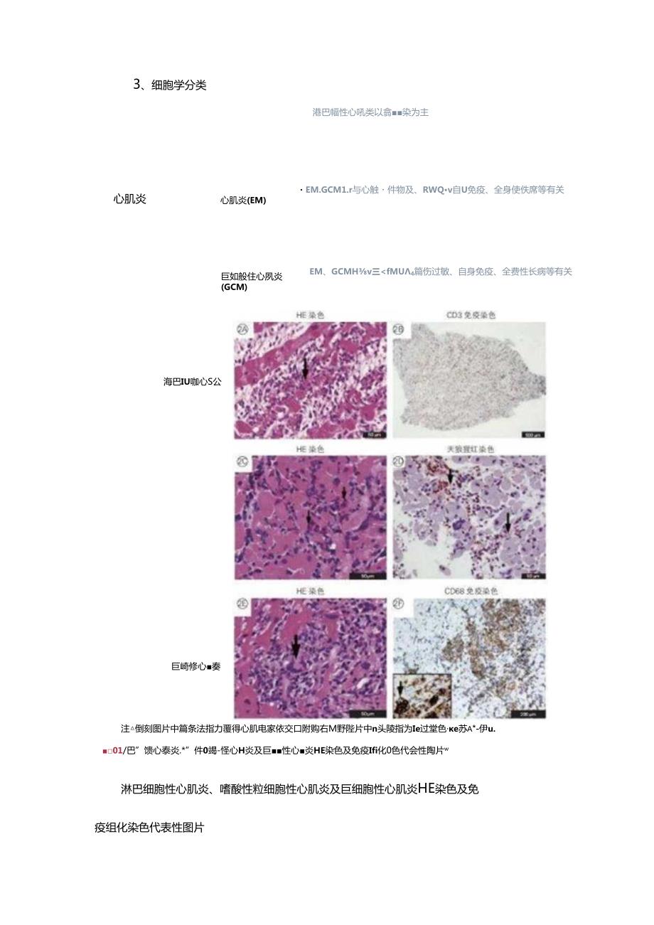中国成人心肌炎临床诊断2024.docx_第3页