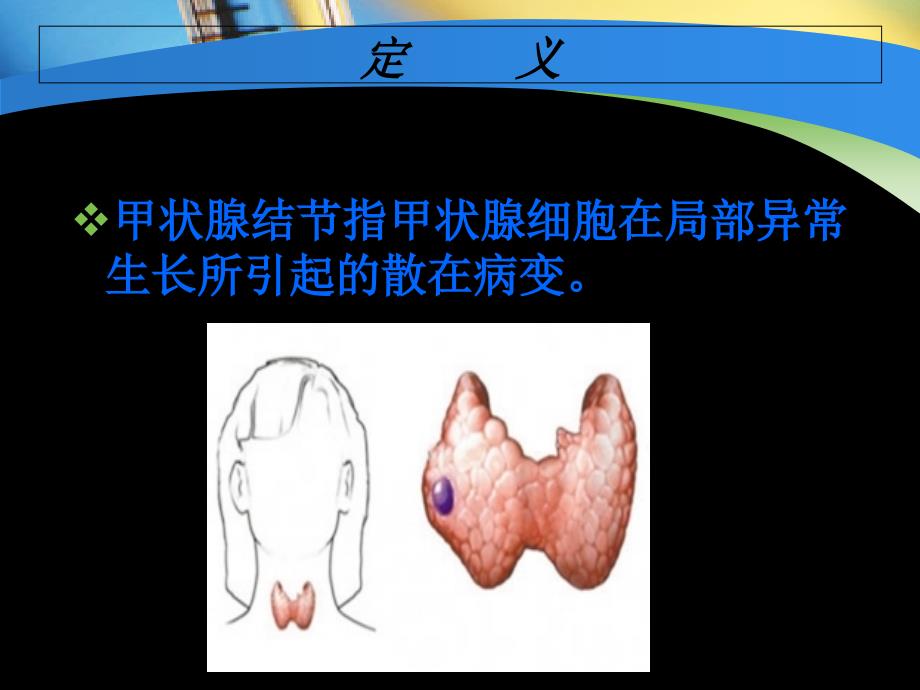 2019甲状腺结节诊治指南29页PPT文档.ppt_第3页