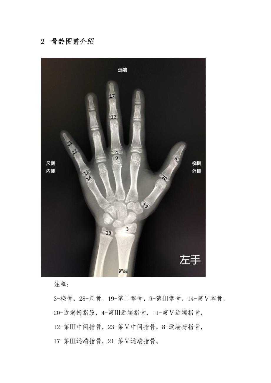 TW3骨龄评分法解释.doc_第3页