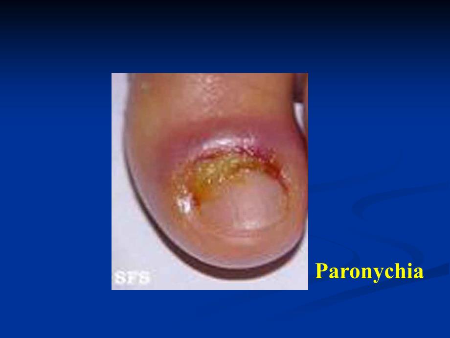 SurgicalInfection外科感染.ppt_第2页