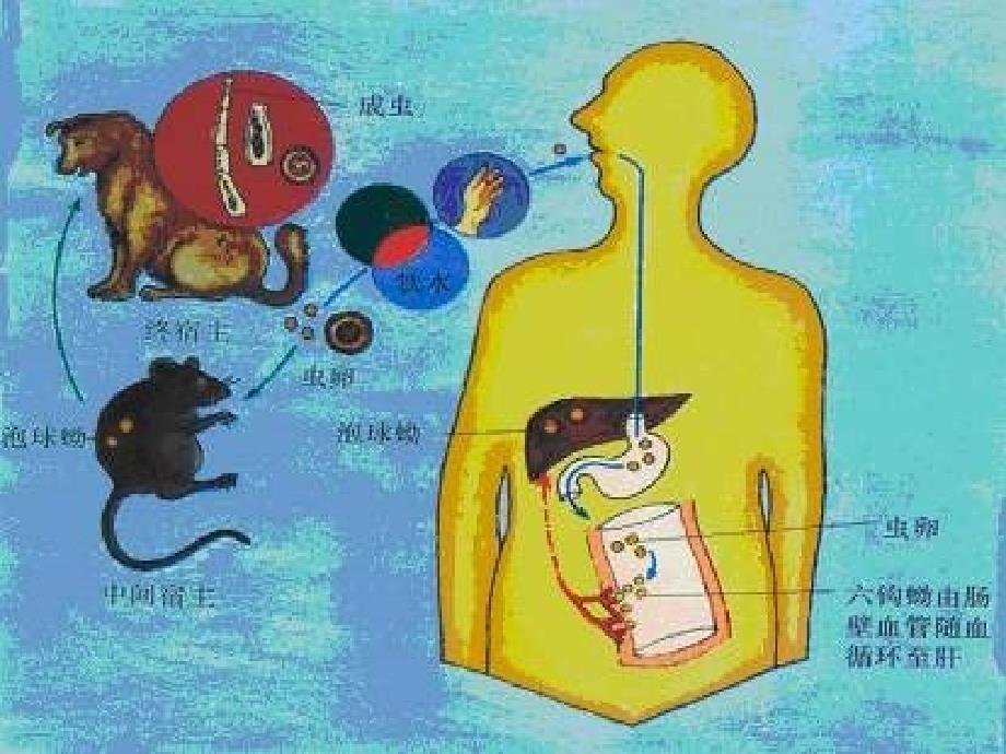 包虫病ppt课件.ppt_第3页