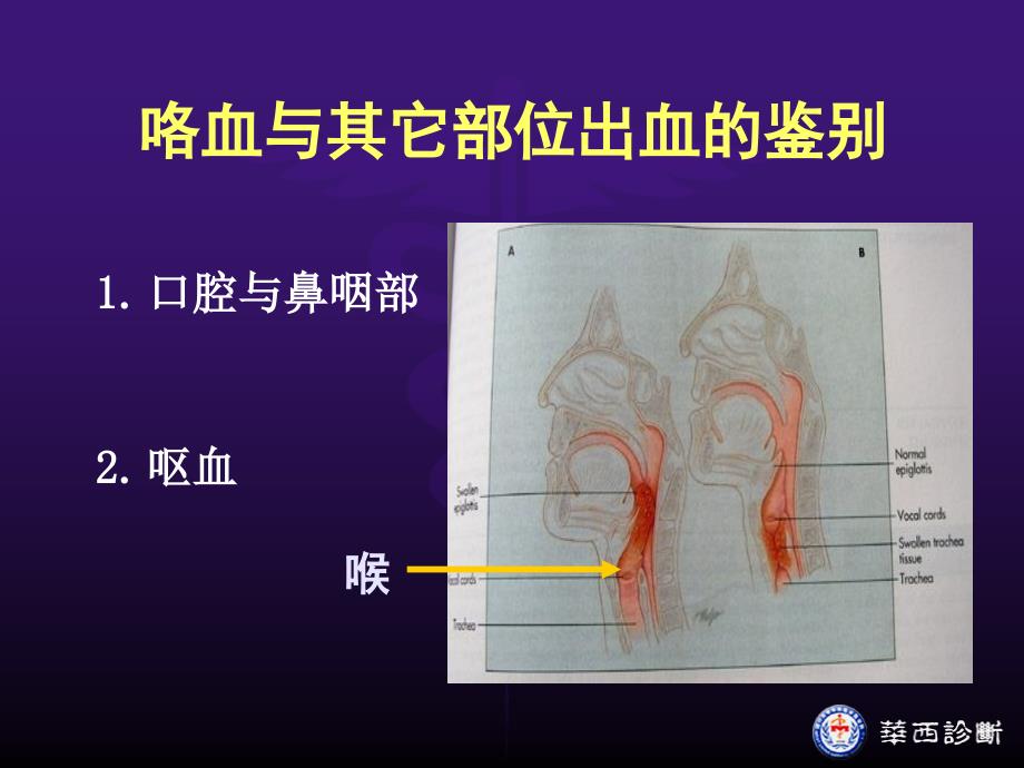 咯血课件.ppt_第3页