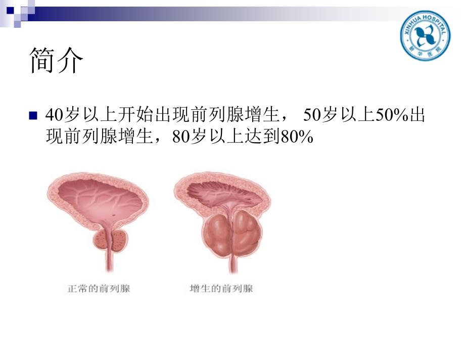 前列腺增生教学查房课件.pptx_第3页