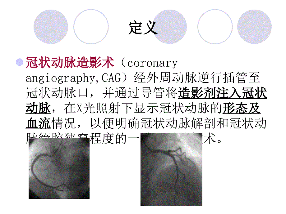 冠脉造影及支架植入术的护理PPT课件.ppt_第2页