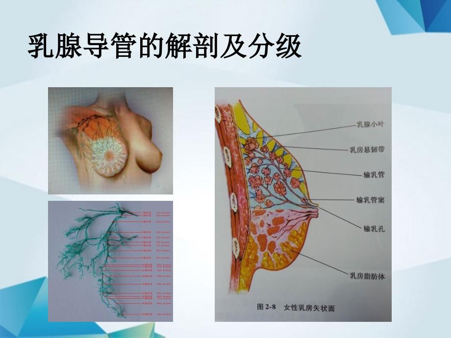 乳头溢液的诊断及处理课件.ppt_第3页