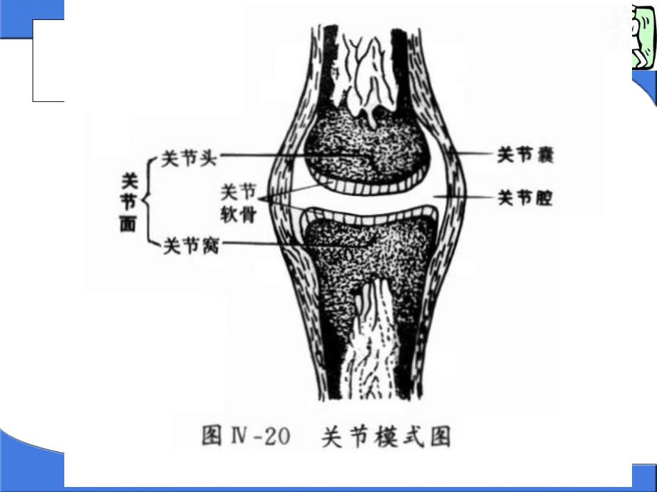 关节脱位病人的护理PPT.ppt_第3页