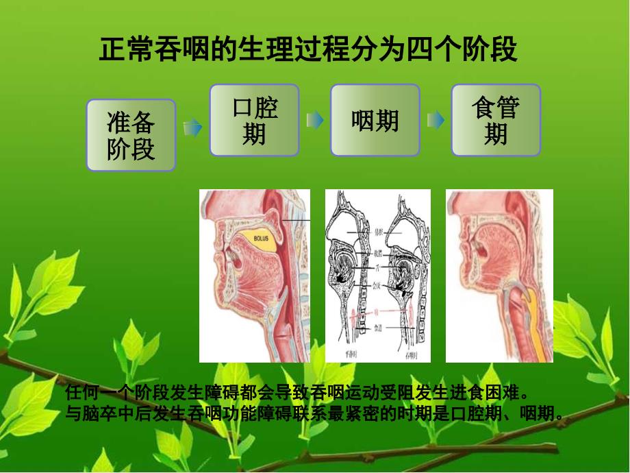 卒中患者吞咽困难的康复护理.ppt_第3页