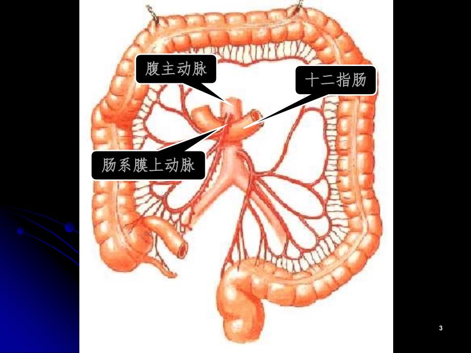 十二指肠淤积症课堂PPT.ppt_第3页