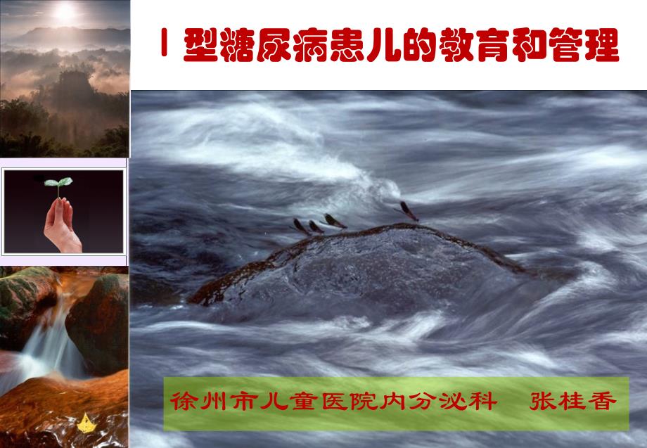 儿童型糖尿病.ppt_第1页