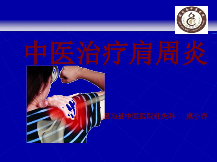 中医治疗肩周炎.ppt_第1页