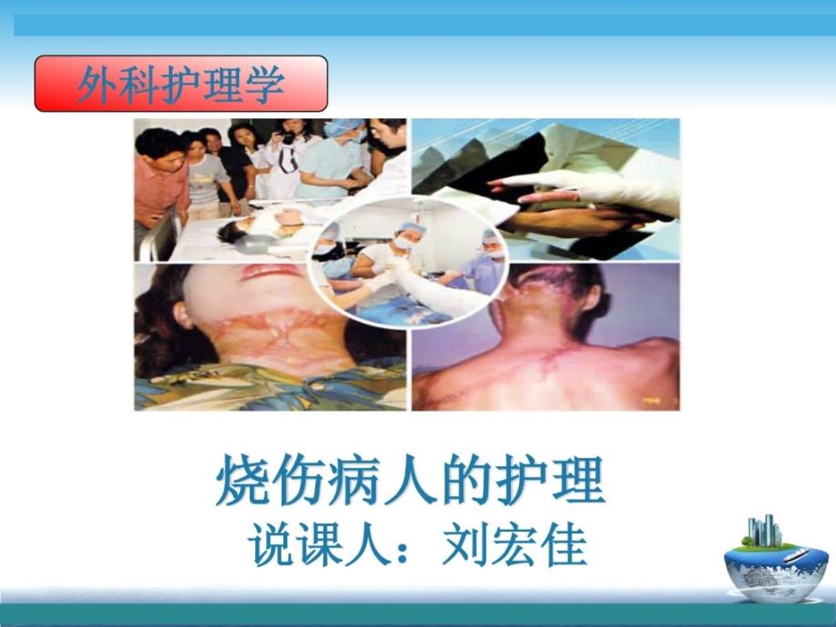 外科说课课件烧伤病人的护理刘宏佳.ppt_第1页