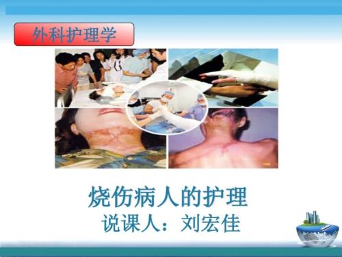 外科说课课件烧伤病人的护理刘宏佳.ppt