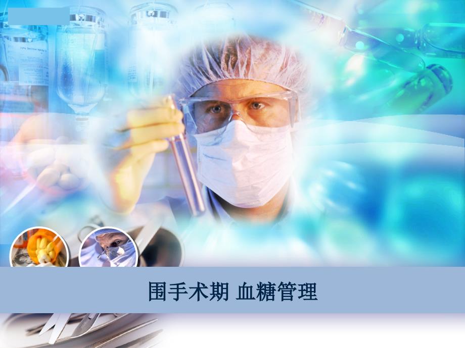 围手术期血糖管理.ppt_第1页