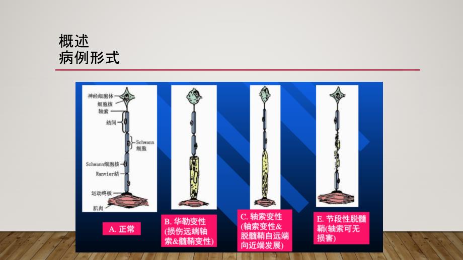 周围神经病PPT课件.ppt_第2页